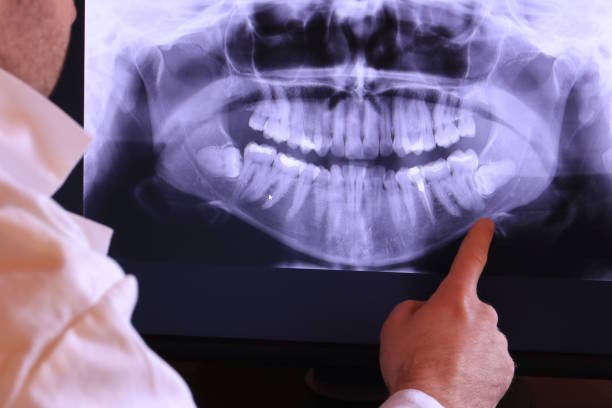 Best Urgent Dental Care for Toothache in Canutillo, TX