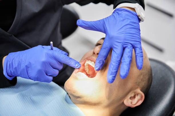 Best Emergency Dental Care for Abscessed Tooth in Canutillo, TX